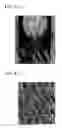 Fig. 05 - Image processing method, apparatus, and program