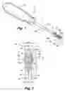 Fig. 02 - Staple removal tool