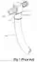 Fig. 02 - Compression clamp