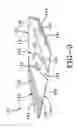 Fig. 06 - Blender blade
