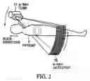 Fig. 03 - X-ray CT apparatus
