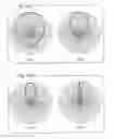 Fig. 05 - Speaker apparatus