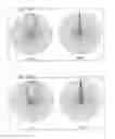 Fig. 07 - Speaker apparatus