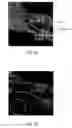Fig. 04 - System and method for automatic bone extraction from a medical image