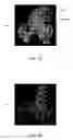 Fig. 06 - System and method for automatic bone extraction from a medical image