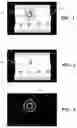 Fig. 02 - Image subtraction of illumination artifacts