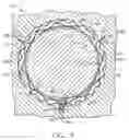 Fig. 08 - Hydrodynamic journal foil bearing system