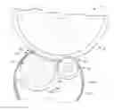 Fig. 01 - Backup belt assembly for use in a fusing system and fusing systems therewith
