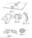 Fig. 02 - Ring binder assembly device to insure the perfected closure of binder rings