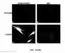 Fig. 10 - Methods and compositions related to 1-caldesmon