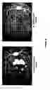 Fig. 20 - Chimeric and humanized antibodies to α5β1 integrin that modulate angiogenesis