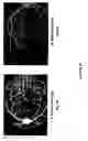 Fig. 22 - Chimeric and humanized antibodies to α5β1 integrin that modulate angiogenesis