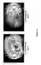 Fig. 24 - Chimeric and humanized antibodies to α5β1 integrin that modulate angiogenesis