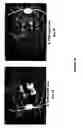 Fig. 25 - Chimeric and humanized antibodies to α5β1 integrin that modulate angiogenesis
