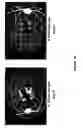 Fig. 26 - Chimeric and humanized antibodies to α5β1 integrin that modulate angiogenesis