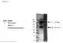 Fig. 30 - Purification and preferential synthesis of binding molecules
