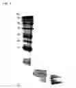 Fig. 07 - Immune stimulating and controlling composition comprising bacterial chromosomal DNA fragments and non-toxic lipopolysaccharides