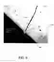 Fig. 06 - Medical device having a smooth, hardened surface