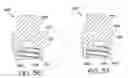 Fig. 07 - Anchoring element for use in bone