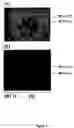 Fig. 27 - Starch branching enzyme