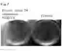 Fig. 05 - Adipocyte differentiation-associated gene and protein