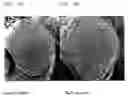 Fig. 02 - Growth regulating proteins