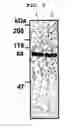 Fig. 06 - Method for measuring the amount of betaig-h3 protein and diagnostic kit using the same
