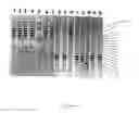 Fig. 03 - Nucleic acid probes and methods for detecting clinically important fungal pathogens