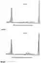 Fig. 04 - Analyzing and typing monoclonal proteins by capillary electrophoresis and immunodisplacement