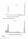 Fig. 06 - Analyzing and typing monoclonal proteins by capillary electrophoresis and immunodisplacement