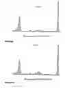 Fig. 11 - Analyzing and typing monoclonal proteins by capillary electrophoresis and immunodisplacement