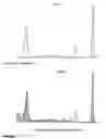 Fig. 12 - Analyzing and typing monoclonal proteins by capillary electrophoresis and immunodisplacement