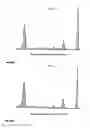 Fig. 13 - Analyzing and typing monoclonal proteins by capillary electrophoresis and immunodisplacement