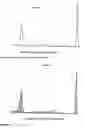 Fig. 15 - Analyzing and typing monoclonal proteins by capillary electrophoresis and immunodisplacement