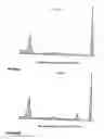 Fig. 20 - Analyzing and typing monoclonal proteins by capillary electrophoresis and immunodisplacement