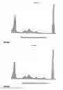 Fig. 27 - Analyzing and typing monoclonal proteins by capillary electrophoresis and immunodisplacement