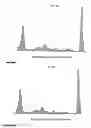 Fig. 28 - Analyzing and typing monoclonal proteins by capillary electrophoresis and immunodisplacement
