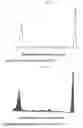Fig. 30 - Analyzing and typing monoclonal proteins by capillary electrophoresis and immunodisplacement