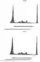 Fig. 32 - Analyzing and typing monoclonal proteins by capillary electrophoresis and immunodisplacement