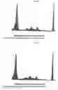 Fig. 33 - Analyzing and typing monoclonal proteins by capillary electrophoresis and immunodisplacement