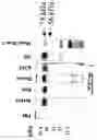 Fig. 02 - Methods for screening for a compound useful in the treatment or prevention of lymphocytic disorders, for inhibiting lymphocite activity and preventing or treating lymphocytic disorders