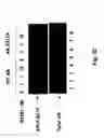 Fig. 03 - Antibodies that recognize and bind phosphorylated human androgen receptor and methods of using same
