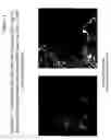 Fig. 03 - Method of detecting coliform bacteria and bacteria from reflected light