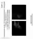 Fig. 22 - Method of detecting coliform bacteria and bacteria from reflected light