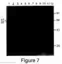 Fig. 14 - Nucleic acid encoding GAD65