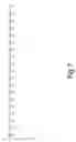 Fig. 08 - Methods for degrading lignocellulosic materials