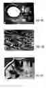 Fig. 07 - Primate embryonic stem cell line