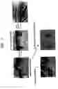 Fig. 02 - Method of isolating epithelial cells, method of preconditioning cells, and methods of preparing bioartificial skin and dermis with the epithelial cells and preconditioned cells