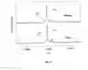 Fig. 12 - METHOD AND APPARATUS FOR MASS SPECTROMETRIC IMMUNOASSAY ANALYSIS OF SPECIFIC BIOLOGICAL FLUID PROTEINS