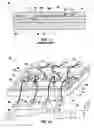 Fig. 02 - Semiconductor substrates including I/O redistribution using wire bonds and anisotropically conductive film, methods of fabrication and assemblies including same